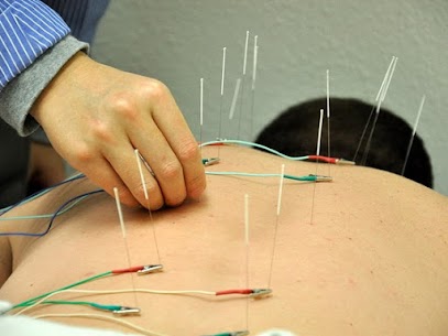 What is acupuncture - pic of a persons back with acupuncture needles